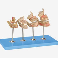 Set - Modelo dental desarrollo de dientes temporales hasta permanentes