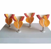 Modelo de prostata y vejiga
