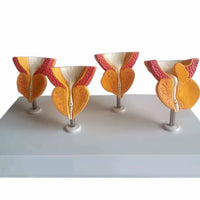 Modelo de prostata y vejiga