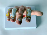Modelo de Mano patologia tendon y ligamento osteoartritis
