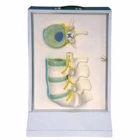 Simulador de Disco intervertebral columna vertebra eléctrico