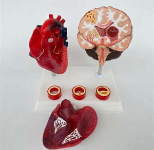 Modelo de corazon trombosis Vascular con Cerebro