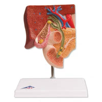 Modelo de cálculos biliares - Alta Simulacion