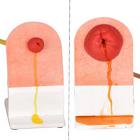 Simulador de ostomia colostomia urostomia