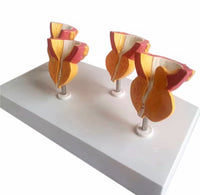 Modelo de prostata y vejiga
