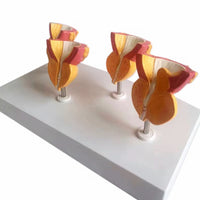 Modelo de prostata y vejiga