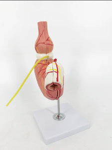 Modelo anatomico de estomago - banda gastrica bariatrica