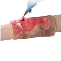 Kit de modelo de simulacion realista de quemaduras de segundo y tercer grado en extremidades