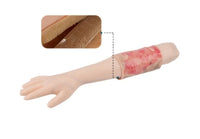 Kit de modelo de simulacion realista de quemaduras de segundo y tercer grado en extremidades
