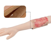 Kit de modelo de simulacion realista de quemaduras de segundo y tercer grado en extremidades