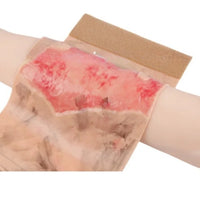 Kit de modelo de simulacion realista de quemaduras de segundo y tercer grado en extremidades