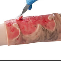 Kit de modelo de simulacion realista de quemaduras de segundo y tercer grado en extremidades