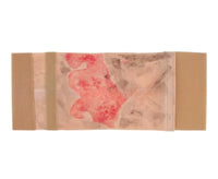 Kit de modelo de simulacion realista de quemaduras de segundo y tercer grado en extremidades
