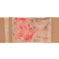 Kit de modelo de simulacion realista de quemaduras de segundo y tercer grado en extremidades