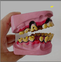 Modelo De Dientes De Fumador
