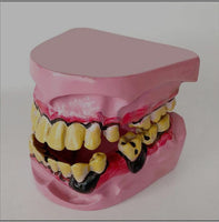 Modelo De Dientes De Fumador
