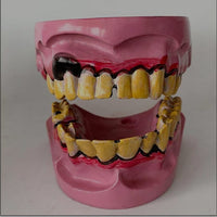 Modelo De Dientes De Fumador
