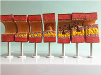 Modelo de anatomía de la arteria humana aterosclerosis
