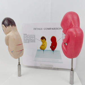 Modelo anatomico  feto comparativo fumados Vs saludable