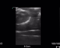 simulador testicular phantom de biopsia puncion - ultrasonido
