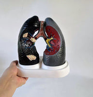 Modelo anatomico comparativo pulmon de fumador
