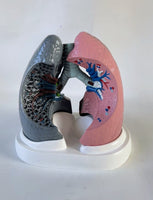 Modelo anatomico comparativo pulmon de fumador

