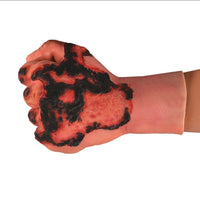 Kit de modelo de simulacion realista de quemaduras de segundo y tercer grado en extremidades
