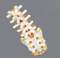 Simulador cirugias de Ligamentos Ortopedia Trauma
