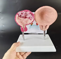 Modelo de comparación entre la vejiga de fumar y normal urologia
