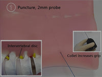 Simulador vertebral lumbar Espejo de Apertura intervertebral
