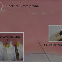 Simulador vertebral lumbar Espejo de Apertura intervertebral