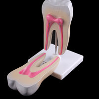 Estructura de molar humana saludable