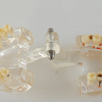 Modelo dental  patologico completo