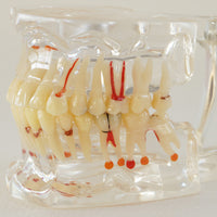 Modelo dental  patologico completo