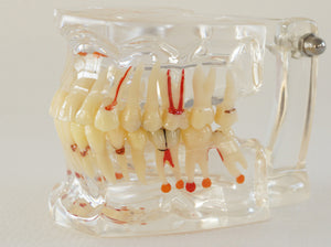 Modelo dental  patologico completo