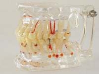 Modelo dental  patologico completo
