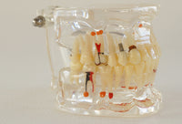 Modelo dental  patologico completo
