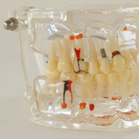 Modelo dental  patologico completo