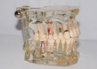 Modelo dental  patologico completo
