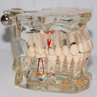 Modelo dental  patologico completo