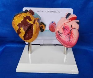 Modelo anatomico comparativo corazon de fumador