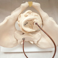 Pelvis fetal de mujer con cabeza de bebe