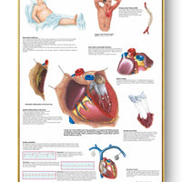 Póster de patologías humanas 