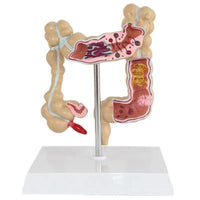 Modelo de colon