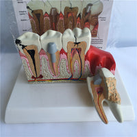  Modelo Anatomico Dental- Patología.
