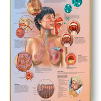 Póster Anatomía y enfermedades humanas 