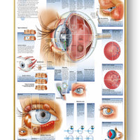 Póster Anatomía y enfermedades humanas 