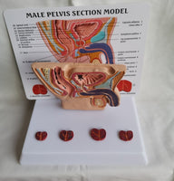 Pelvis masculina con vejiga y prostata
