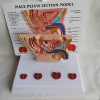 Pelvis masculina con vejiga y prostata