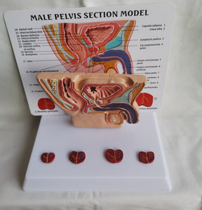 Pelvis masculina con vejiga y prostata